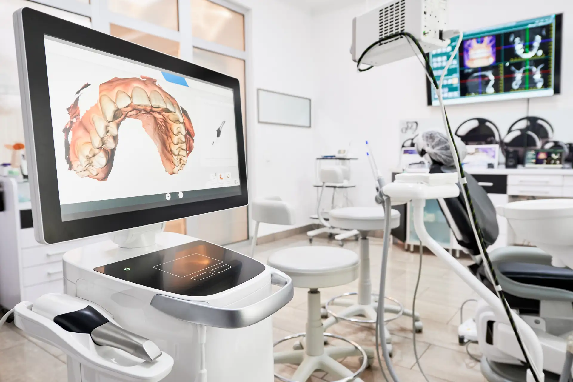 dental intraoral scanner in modern clinic 2025 01 16 22 16 50 utc copy